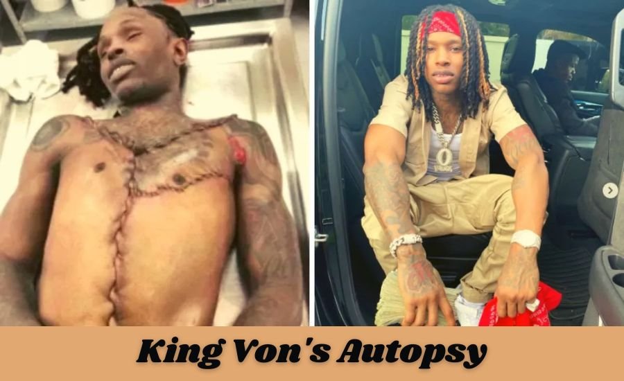 king von's autopsy